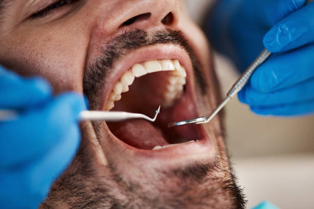 Best Emergency Treatment for Dental Infections or Abscesses in Oak Hills, CA
