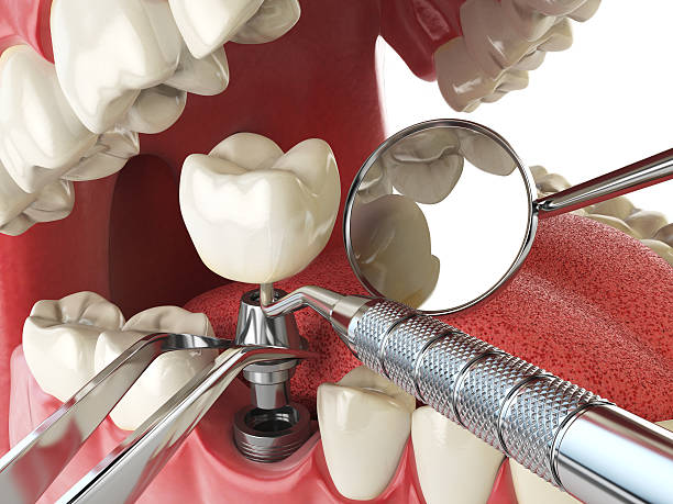 Best After-Hours Dental Trauma Care in Oak Hills, CA