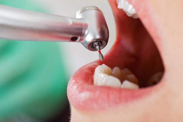Best Emergency Gum Treatment in Oak Hills, CA
